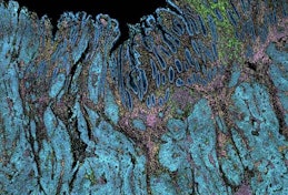 Thumbnail image for news item