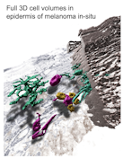 Thumbnail image for news item