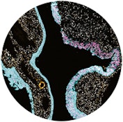 Thumbnail image for news item