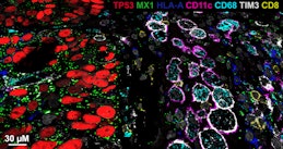 Thumbnail image for news item