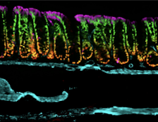 Epigenetic and oncogenic inhibitors cooperatively drive differentiation and kill KRAS-mutant colorectal cancers