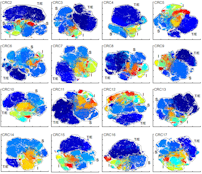 Multiplexed 3D atlas of state transitions and immune interactions in colorectal cancer.