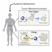 Obesity shapes metabolism in the tumor microenvironment to suppress anti-tumor immunity.