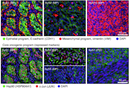 Opposing immune and genetic mechanisms shape oncogenic programs in synovial sarcoma.