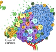 Ovarian cancer-derived IL-4 promotes immunotherapy resistance