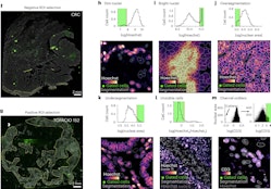 Quality control for single-cell analysis of high-plex tissue profiles using CyLinter.