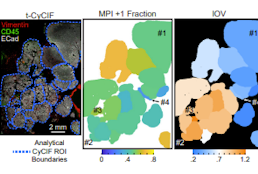 Temporal and spatial topography of cell proliferation in cancer.