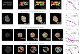 Universal consensus 3D segmentation of cells from 2D segmented stacks.